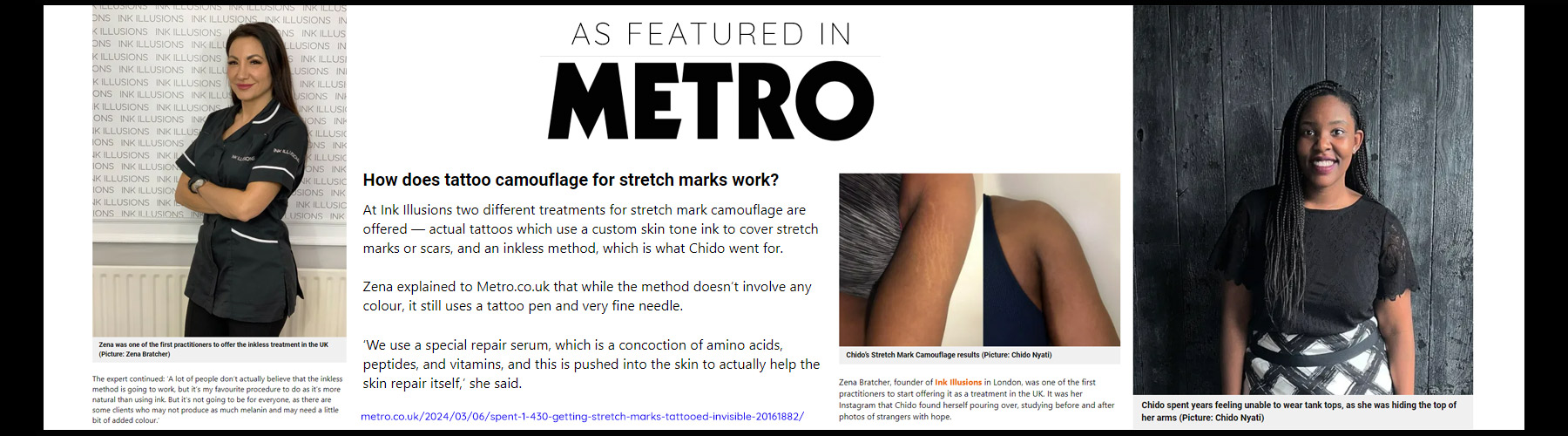 featured in Metro article on stretch marks