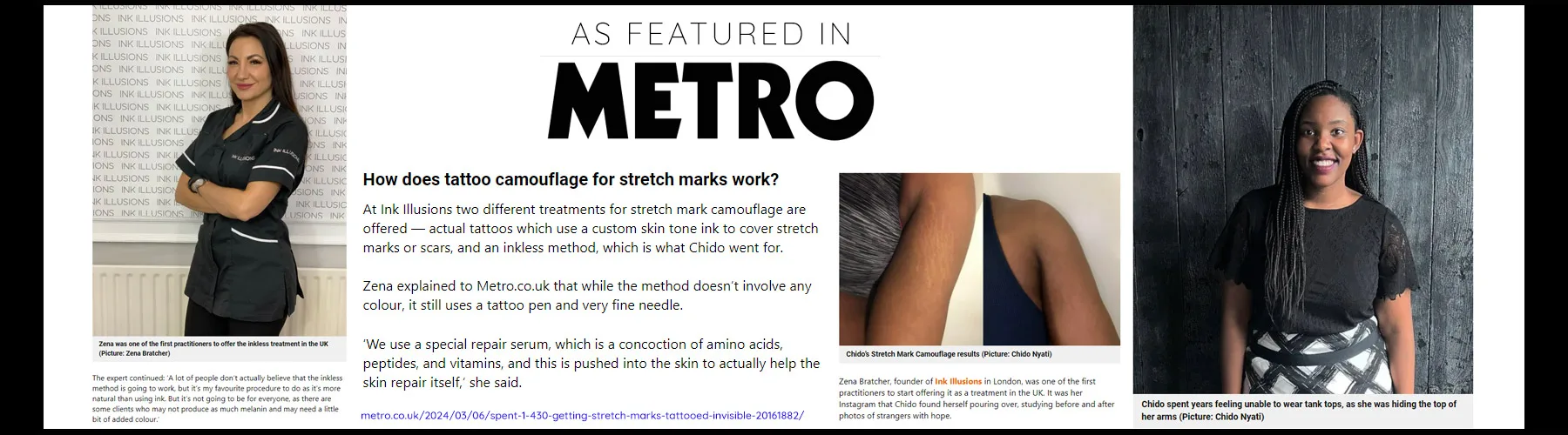 featured in Metro article on stretch marks