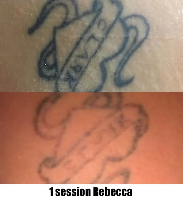 https://www.ink-illusion.com/wp-content/uploads/2018/06/1-session-rebecca.webp