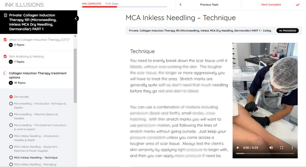 Collagen Induction Therapy - Inkless MCA needling, Microneedling, Dermaroller Ink Illusions