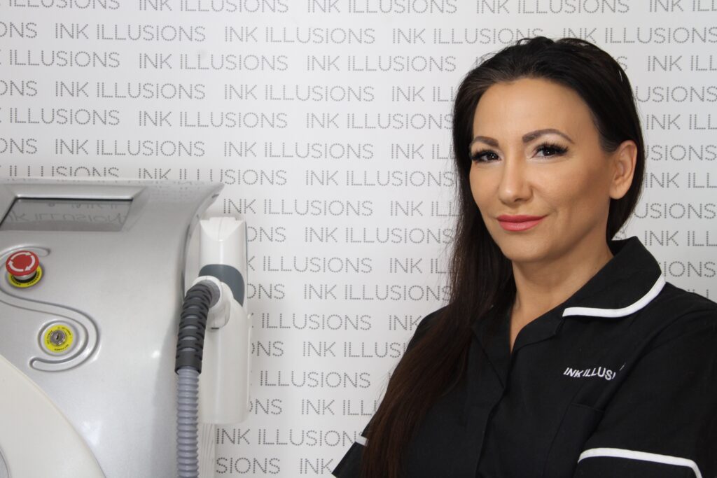 Laser tattoo removal Brentwood Essex Ink Illusions