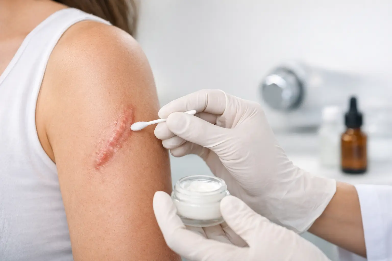 How to Treat Hypertrophic Scars Safely
