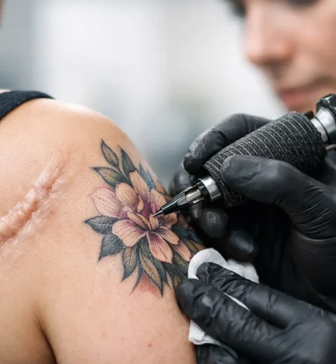 When Can Scars Be Tattooed Safely? Expert Timing